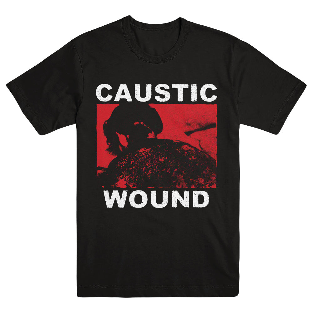 Caustic Wound Merch Burn Shirt Caustic Wound Shirt Father'S Day Gifts For Husband Caustic Wound Merch Burn Shirt Caustic Wound Shirt Father'S Day Gifts For Husband