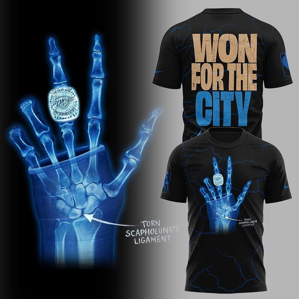 Jalen Williams X-Ray Scapholunate Torn But The Championship's Worn OKC Forever T-Shirt Perfect Gift For Basketball Fans