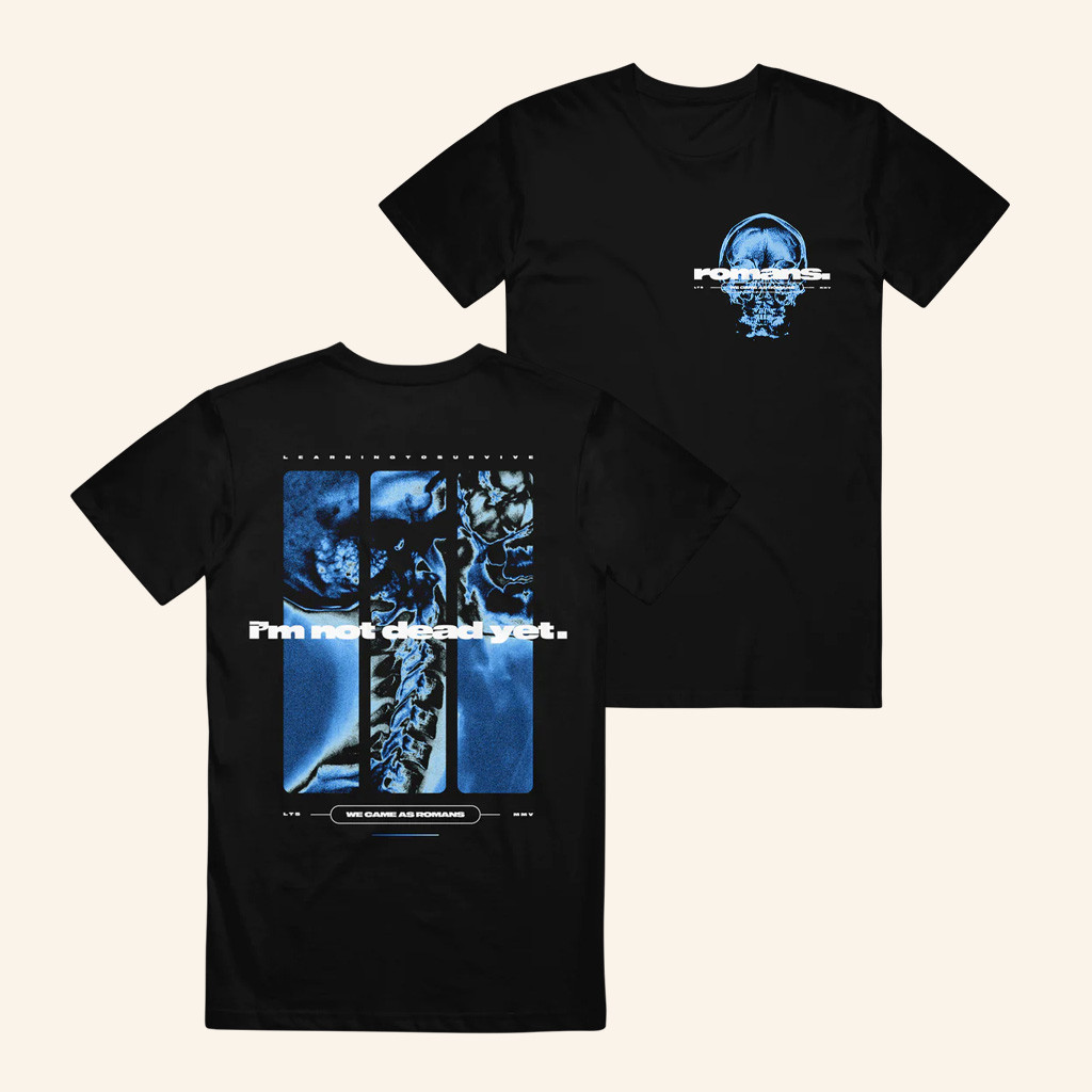 WCAR Band Merch X Ray Shirt Christmas Ideas For Husband WCAR Band Merch X Ray Shirt Christmas Ideas For Husband